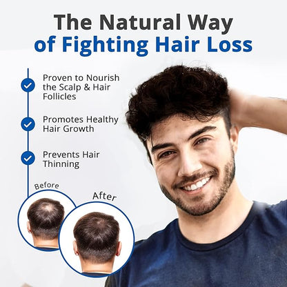 HAIRMETTO Serum for Hair Loss and Regrowth with Saw Palmetto, Stinging Nettle, Rosemary Oils, Peppermint Scent, Unisex,4oz