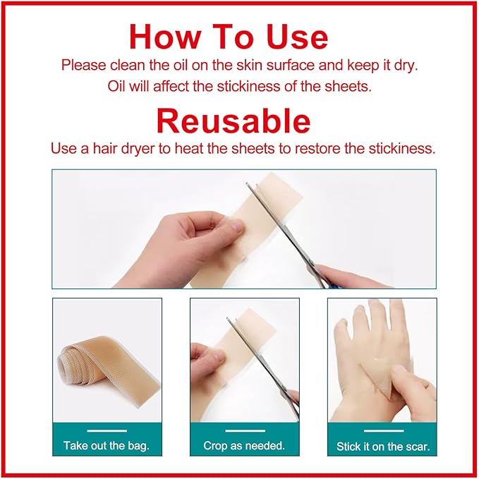 Silicone Scar Sheets (1.6” x 120” Roll-3M), Silicone