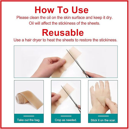 Silicone Scar Sheets (1.6” x 120” Roll-3M), Silicone