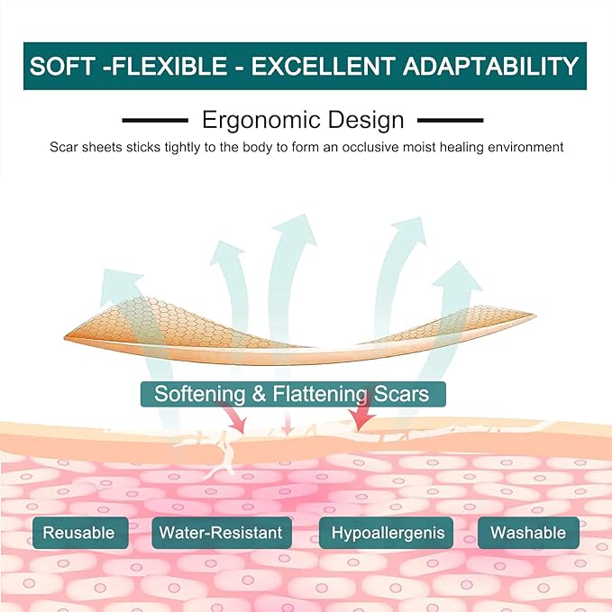 Silicone Scar Sheets (1.6” x 120” Roll-3M), Silicone