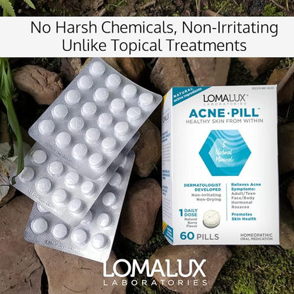Acne Pill -Natural Skin Clearing Minerals Like Zinc & Sulfur, Dermatologist Developed, Clears & Prevents All Types of Face & Body Acne - NO Harsh Chemicals Like Topical Acne Treatments