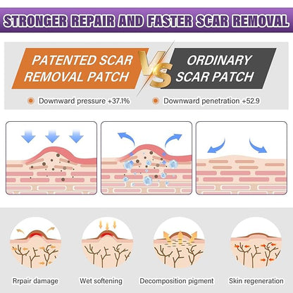 Silicone Scar Sheets,Silicone Scar Tape,Scar Tape Tuck,Keloid(1.6"X 120" 120" Roll-3M) Roll-3M) Keloid