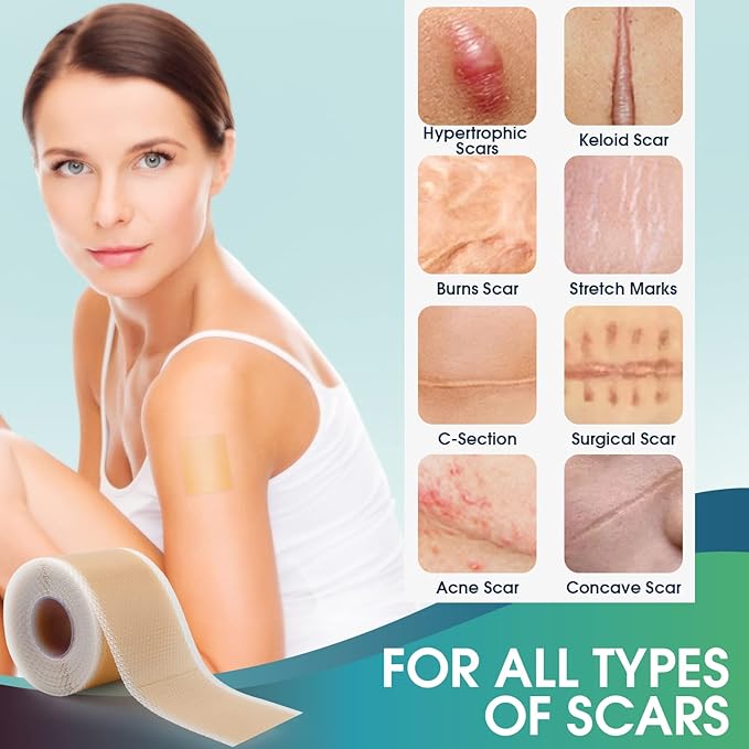 Professional Silicone Scar Sheets (1.6" x 150" Scar Roll-3.8M) -
