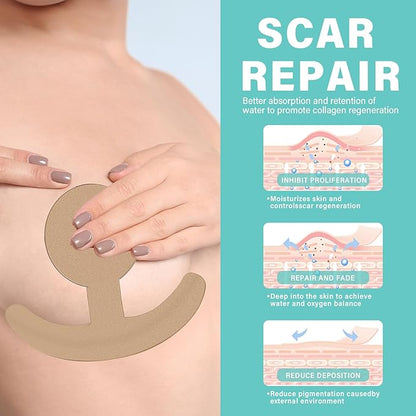 Silicone Scar Sheets, Silicone Scar Tape, 4 Pair