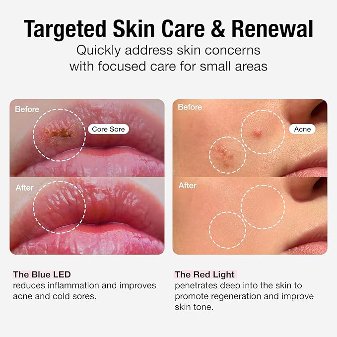 Infrared Red Light Therapy Device 450nm & 670nm Red