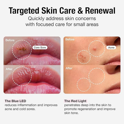 Infrared Red Light Therapy Device 450nm & 670nm Red
