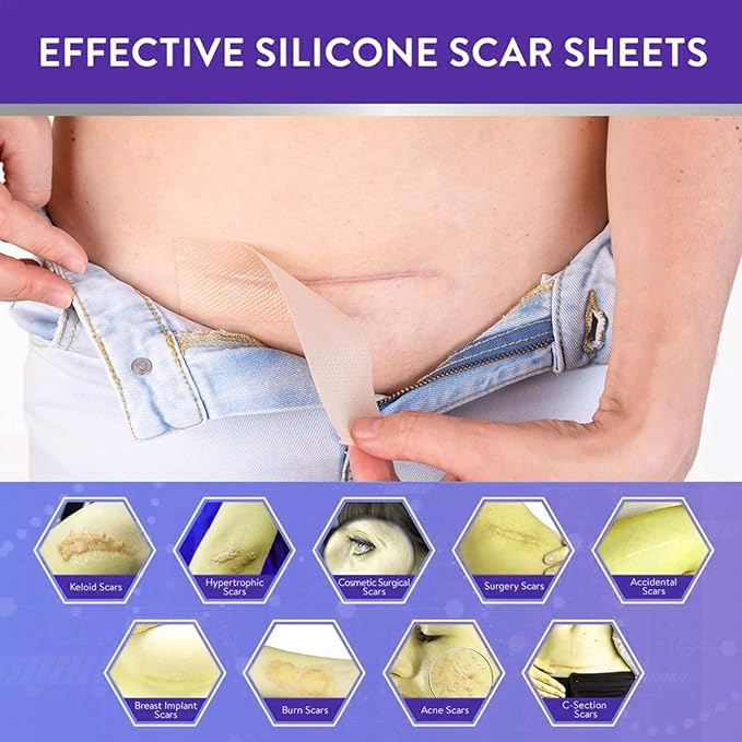 Silicone Scar Sheets,LXIANGN Medical Grade Silicone (1.5”x 120”Roll) 120”Roll)
