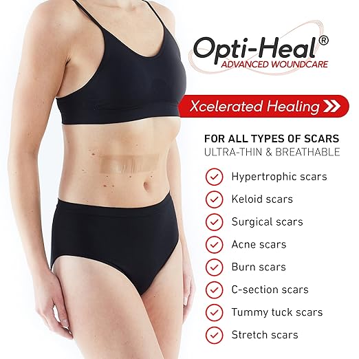 Neo G Opti-Heal Wound Recovery Silicone 1.6 x 5.9 inch 6 Strips