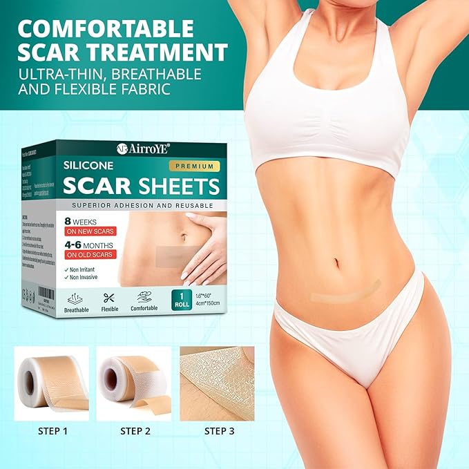Silicone Scar Sheets,Silicone Scar Tape(1.6"x 60" Roll-1.5M), Reusable
