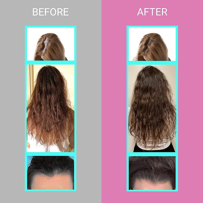 UpNourish Hair Growth Vitamins for Women 5000 mcg 90 ct