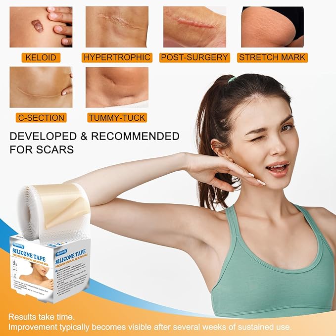 Silicone Scar Sheets Silicone Gel Scar (1.6" x 59"-1.5M) -