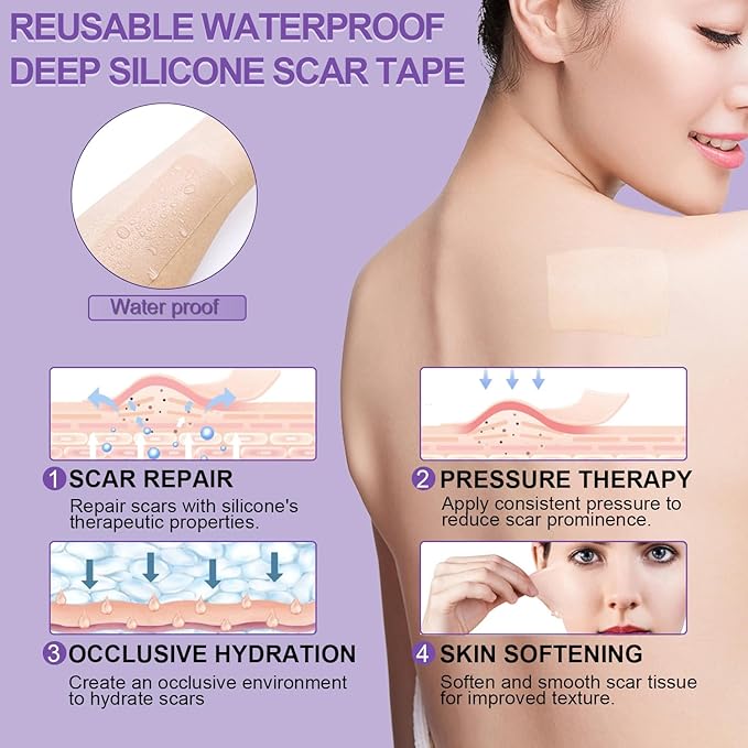 Silicone Scar Sheets, Medical Grade Silicone (1.6" x 120"), Professional