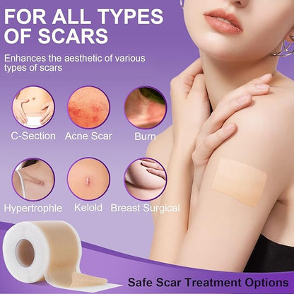 Silicone Scar Sheets, Medical Grade Silicone (1.6" x 120"), Professional