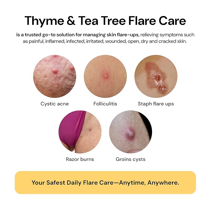 Thyme & Tea Tree Flare Care (1oz)