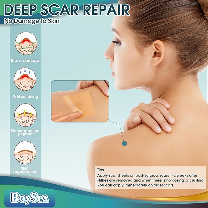Silicone Scar Sheets (1.6" x 120")