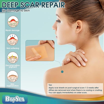 Silicone Scar Sheets (1.6" x 120")