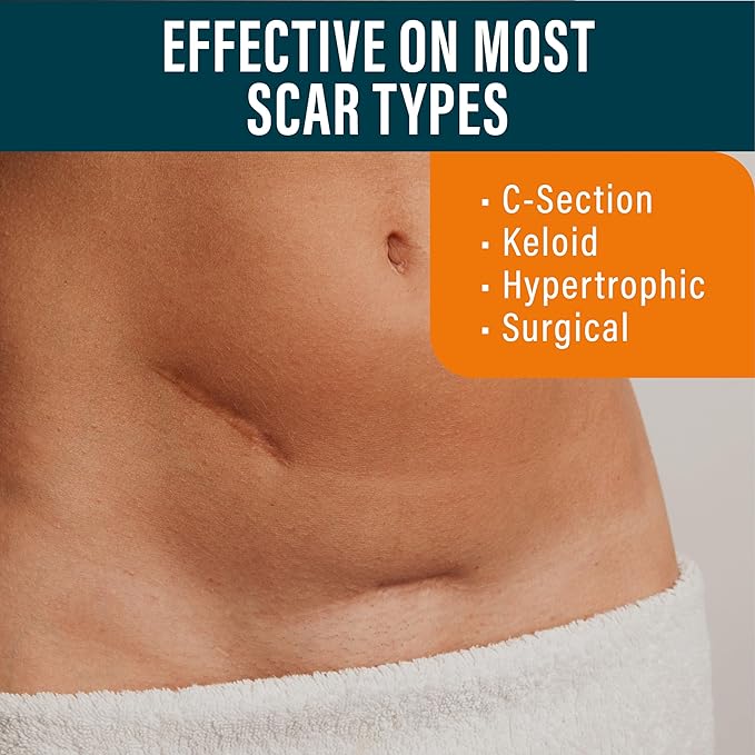 NUVADERMIS Silicone Scar Sheets 2 Packs 4 -