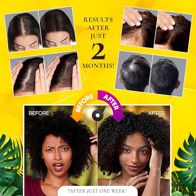100% COLD-PRESSED (Unscented) Batana Oil - Thicker, Fuller Hair! Fights Thinning & Promotes Growth. A Hair & Scalp 'SUPERFOOD'! Repairs Damage & Rich in Vitamin E.