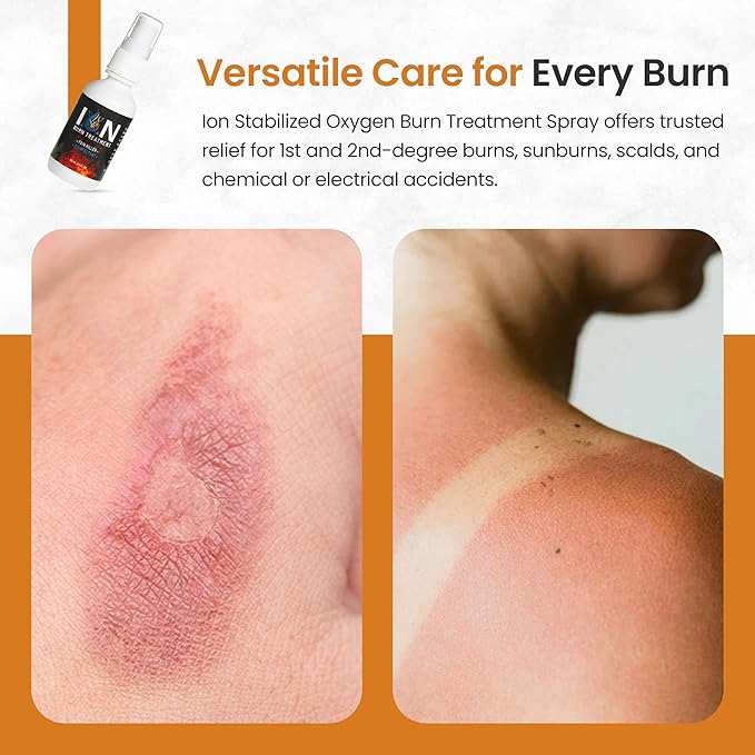 Ion Stabilized Oxygen Burn Treatment Spray 60ml