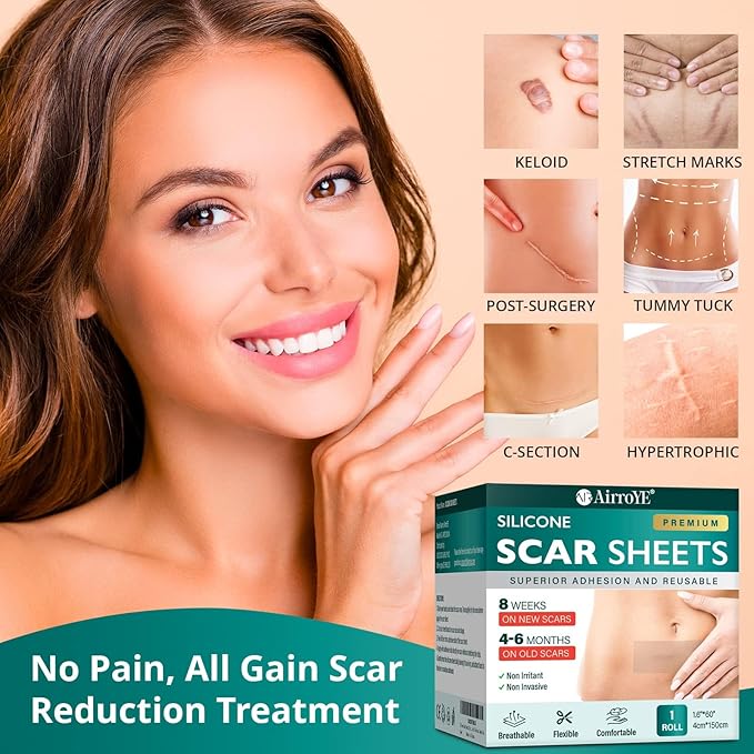 Silicone Scar Sheets,Silicone Scar Tape(1.6"x 60" Roll-1.5M), Reusable