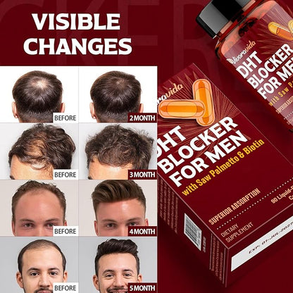 DHT Blocker for Men | Hair Growth Supplement with Saw Palmetto & Biotin - Hair Growth Vitamins - Hair Regrowth - Natural Hair Loss Supplements Liquid-Filled - Proprietary Herbal Blends (90 Capsules)