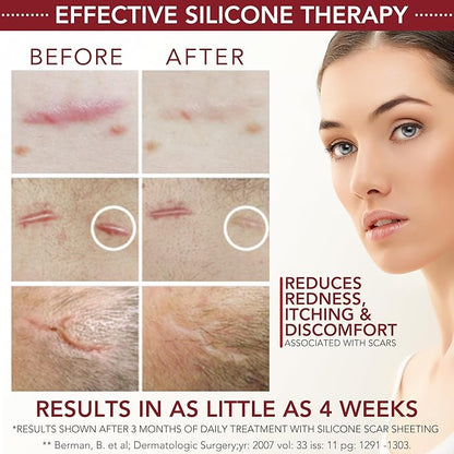 Physician Formulated Silicone Scar Gel Semi-Solid Sheeting