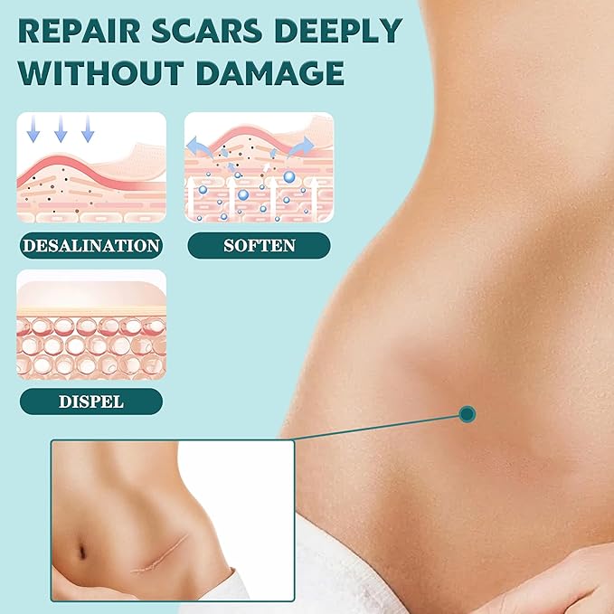 Silicone Scar Sheets,(1.6" X 60" Roll-1.5M)