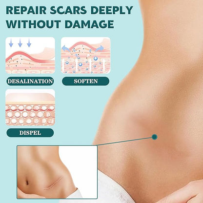 Silicone Scar Sheets,(1.6" X 60" Roll-1.5M)