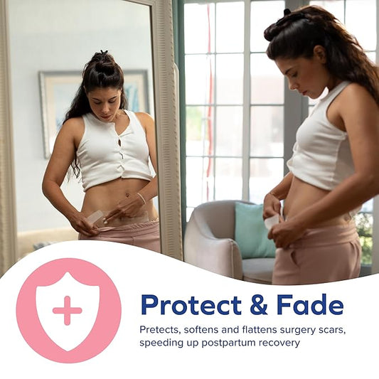 Dr. Talbot's Mom Stretch Mark & 6 Strips (60-Day Supply)
