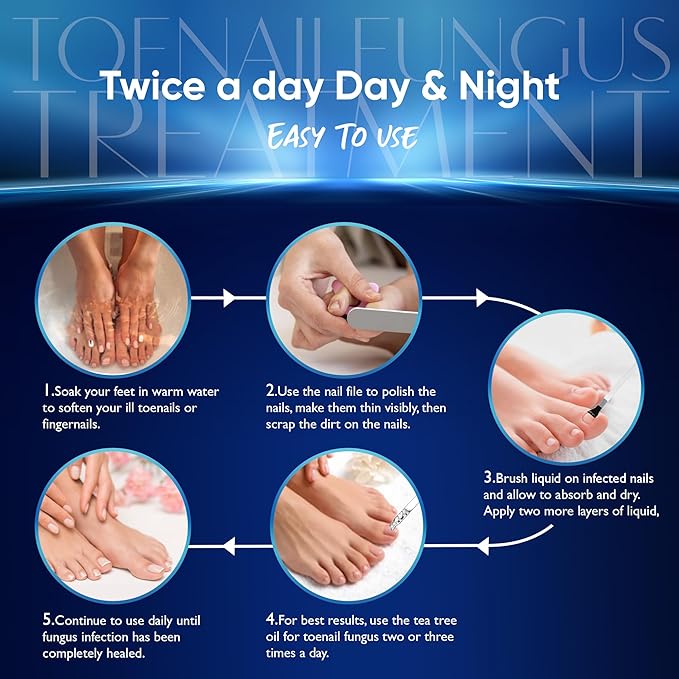 Toenail Fungus Treatment, Nail Fungus Treatment 30ML (1 (1 FLOZ)